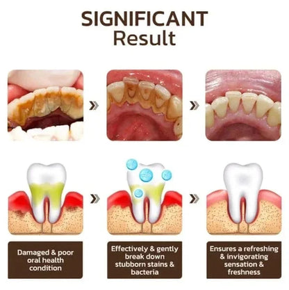 Super Probiotic-6 Toothpaste with Oral microbiota strength [ 3 PACK ]